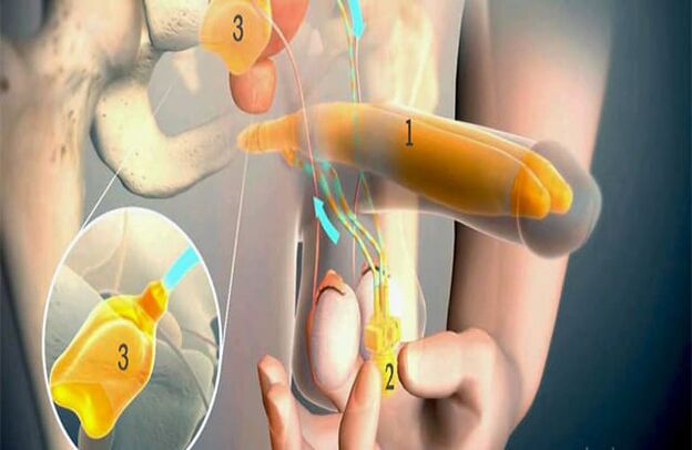 Operación de lipofilling