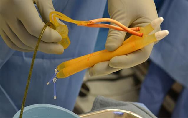 implantes en el pene